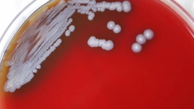 Photo of Hallan en Misisipi la bacteria de una enfermedad rara