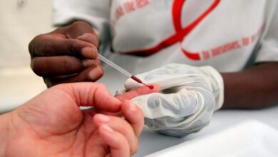 Photo of Onusida: Más de 4 mil personas se infectaron con VIH en República Dominicana en 2021