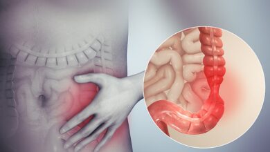 Photo of Qué es el síndrome del intestino irritable y qué hacer para disminuir las molestias